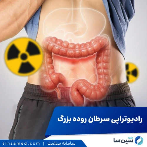 پرتودرمانی سرطان روده بزرگ (کولون): از هزینه تا میزان موفقیت