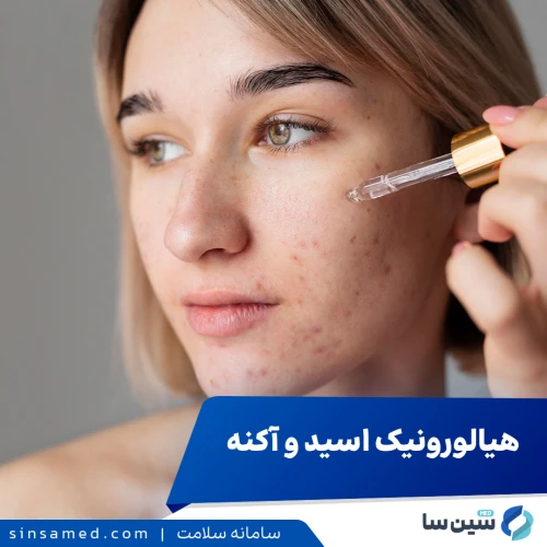 آیا آکنه دارید؟ قدرت هیالورونیک اسید را دست کم نگیرید!