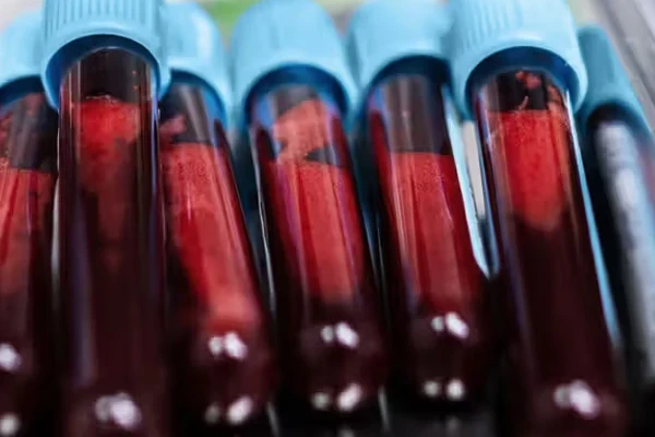 آزمایش بیوپسی مایع می‌تواند بازخورد سریع‌تری در مورد درمان سرطان پستان ارائه دهد