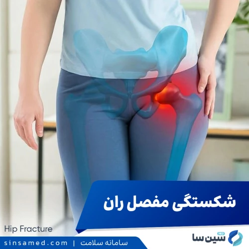 شکستگی مفصل ران | علل بروز، نشانه ها، روش تشخیص و درمان