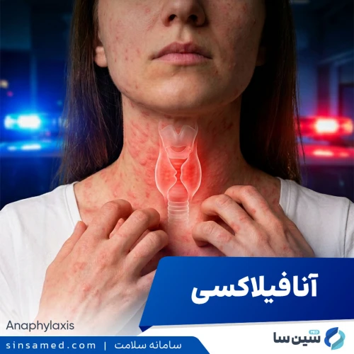 آنافیلاکسی | علل بروز، نشانه ها، روش تشخیص و درمان