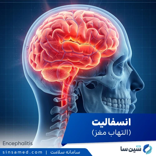 انسفالیت (التهاب مغز) | علل بروز، نشانه ها، تشخیص و درمان
