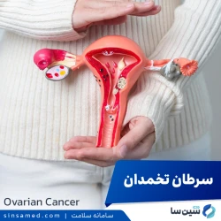 سرطان تخمدان | علل بروز، نشانه ها، روش تشخیص و درمان