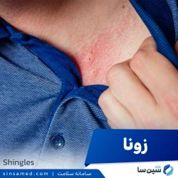 بیماری زونا | علل بروز، نشانه ها، روش تشخیص و درمان