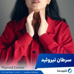 سرطان تیروئید