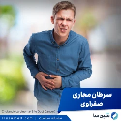 سرطان مجاری صفراوی | علل بروز، نشانه ها، روش تشخیص و درمان آن