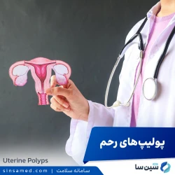 پولیپ های رحم
