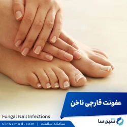 عفونت قارچی ناخن