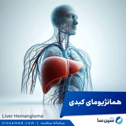 همانژیومای کبدی