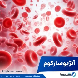 آنژیوسارکوم