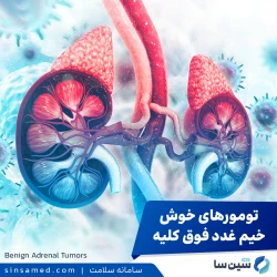 تومورهای خوش خیم غدد فوق کلیه