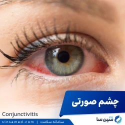 التهاب ملتحمه (چشم صورتی-کنژنکتیویت)