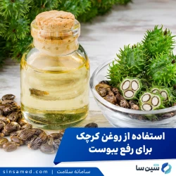 استفاده از روغن کرچک برای رفع یبوست