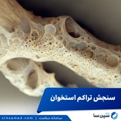 سنجش تراکم استخوان