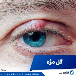 گل مژه