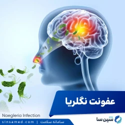 عفونت ناشی از نگلریا