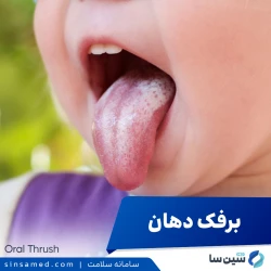 برفک دهان