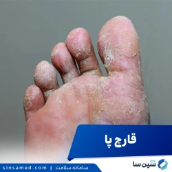 قارچ پا