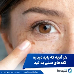 پوست و گذر زمان: هر آنچه درباره لکه‌های پیری و نحوه مدیریت آن‌ها باید بدانید