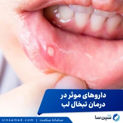 راهنمای انتخاب داروهای موثر در درمان تبخال لب
