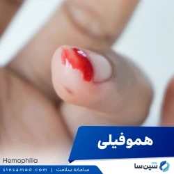هموفیلی