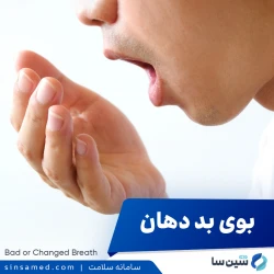 بوی بد دهان