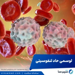 لوسمی حاد لنفوسیتی (ALL)
