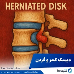 دیسک کمر و گردن