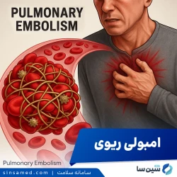آمبولی ریوی