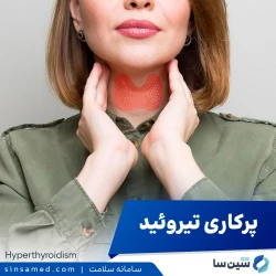 پرکاری تیروئید (هایپرتیروئیدیسم)