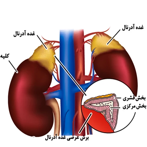 تاثیر داروی آمینوگلوتتیمید بر غدد آدرنال