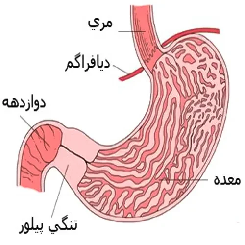 بیماری تنگی پیلور از موارد احتیاطی داروی بالسالازید