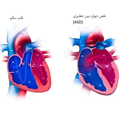 مشکلات قلبی از موارد احتیاطی مصرف داروی بیزوپرولول