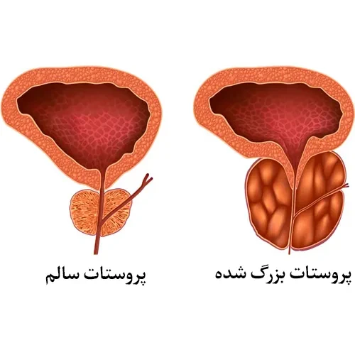 موارد احتیاطی مصرف داروی کلیدینیوم سی