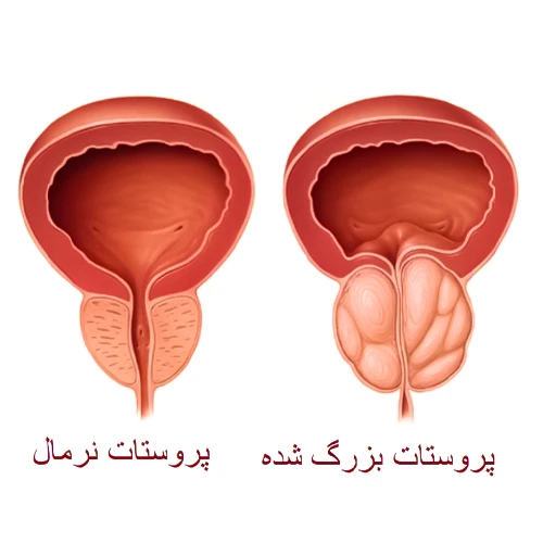 موارد احتیاطی مصرف داروی کلرپرومازین