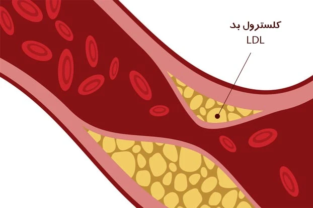 کاهش کلسترول بد خون با مصرف داروی کلستیپول