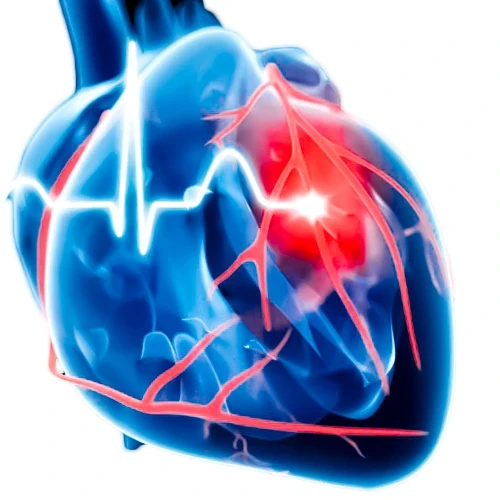 دکسرازوکسان برای کاهش بروز و شدت آسیب قلبی