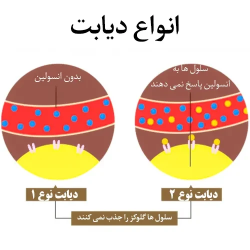 کنترل قند خون در دیابت نوع 2 با مصرف داروی دولاگلوتید