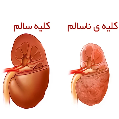 داروی اپوژن (اپوئتین آلفا) جهت درمان سرطان