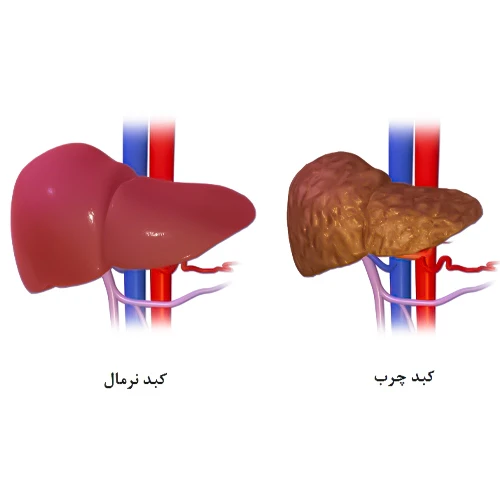 موارد احتیاطی جمتوزوماب اوزوگامیسین