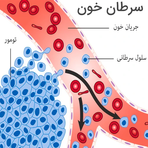 پوناتینیب موثر در درمان سرطان خون