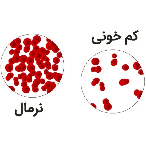 موارد احتیاطی مصرف داروی مبندازول