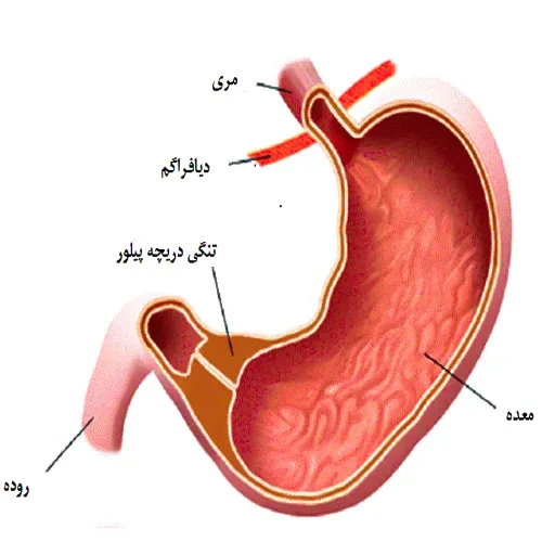 تنگی پیلور از موارد احتیاطی مصرف داروی مزالامین