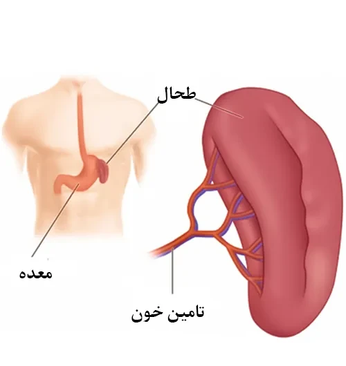 اختلالات طحال ار موارد احتیاطی مصرف داروی پنتوسان پلی سولفات سدیم