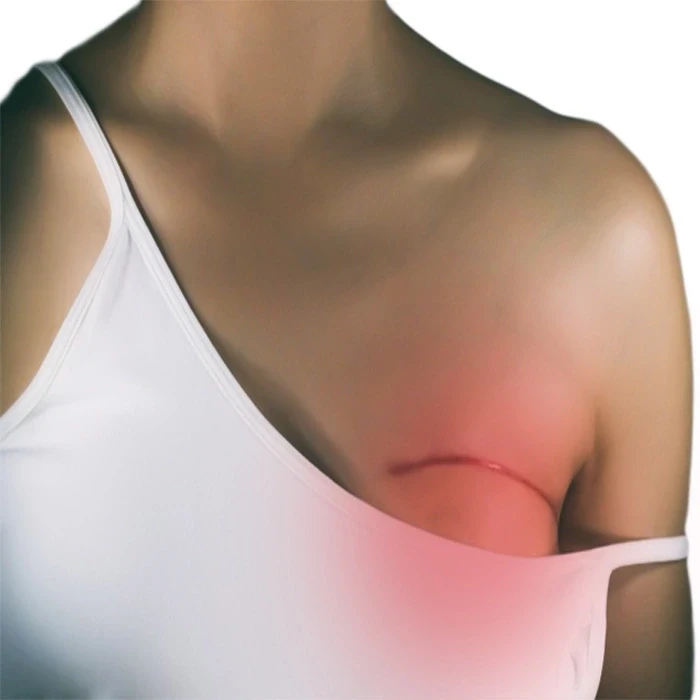 درمان سرطان پستان با داروی پرجتا (پرتوزوماب)