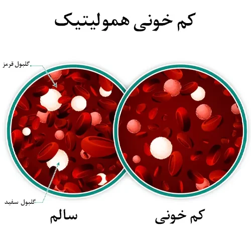 کم خونی همولیتیک از موارد احتیاطی مصرف داروی فنازوپریدین