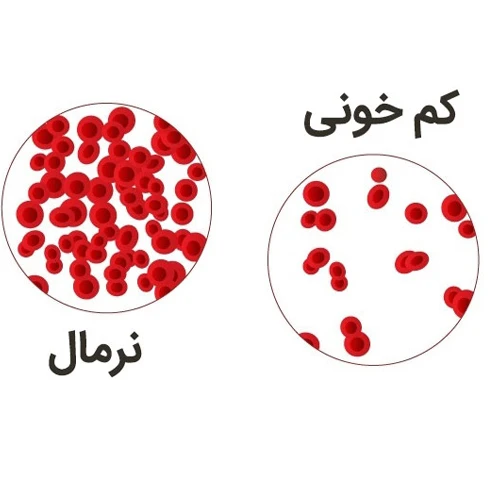 کم خونی از موارد احتیاطی مصرف داروی پیوگلیتازون