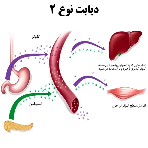 کنترل دیابت نوع 2 با مصرف داروی روزیگلیتازون