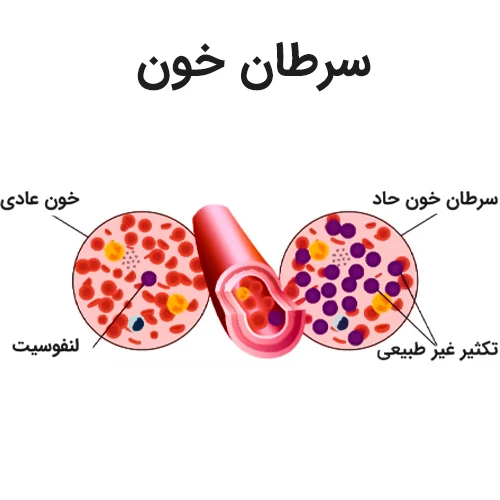 تاثیر میدوستائورین در درمان سرطان خون