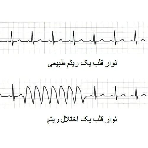 موارد احتیاطی مصرف داروی تلاوانسین